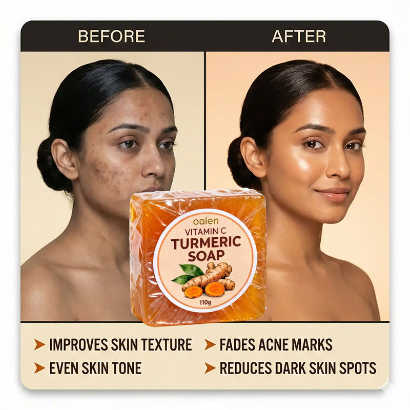Oalen Turmeric Soap Bathing Kojic Acid Dark Spot Remover Soap with Vitamin c for Smooth Soft Skin Daily Use,oalen cosmetics