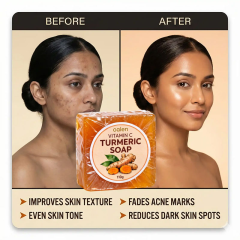 Oalen Turmeric Soap Bathing Kojic Acid Dark Spot Remover Soap with Vitamin c for Smooth Soft Skin Daily Use,oalen cosmetics