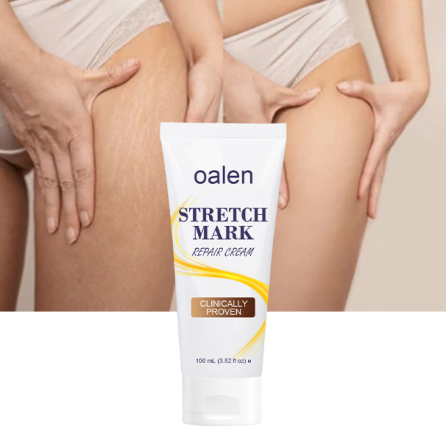 Scar Repair Cream Acne Spot Treatment Stretch Marks Removal Cream Smoothing Firming Moisturizing Skin Care,oalen cosmetics