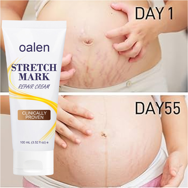 Scar Repair Cream Acne Spot Treatment Stretch Marks Removal Cream Smoothing Firming Moisturizing Skin Care,oalen cosmetics