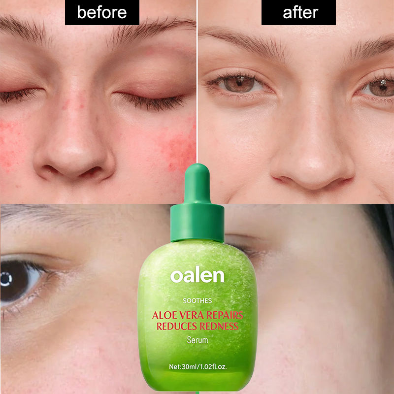 Private Label Calming Aloe Vera Serum Redness Relief Repairing Facial Serum for Sensitive Skin Care,oalen cosmetics