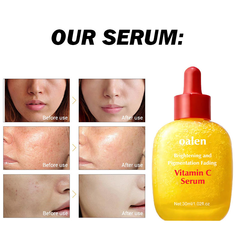 Private Label Vitamin C Serum for Face Anti-Aging Whitening Brightening Improve Appearance Dark Spots Glowing Skin Home Use 30mL,oalen cosmetics