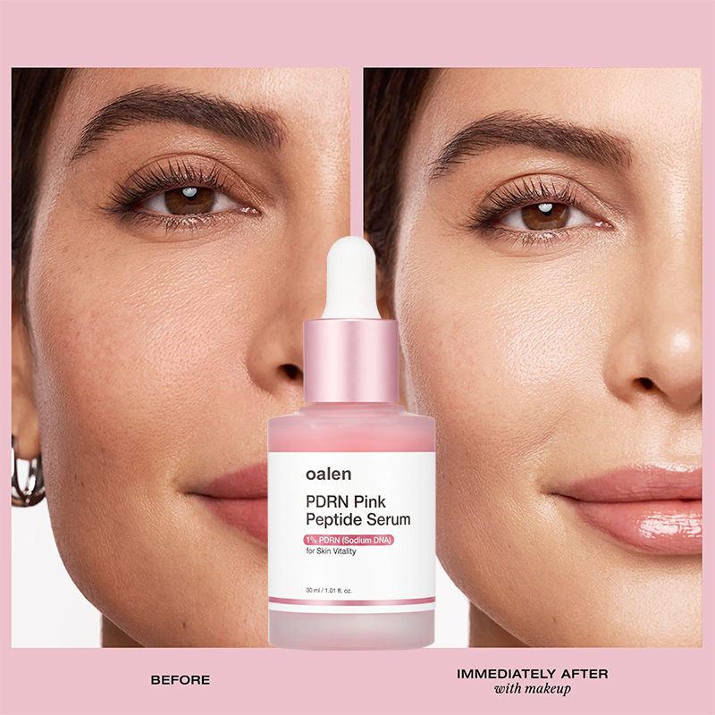 oalen PDRN Pink Peptide Serum 1% Sodium DNA Salmon DNA Hydrating Firming Korean Skin Care 30ml,oalen cosmetics