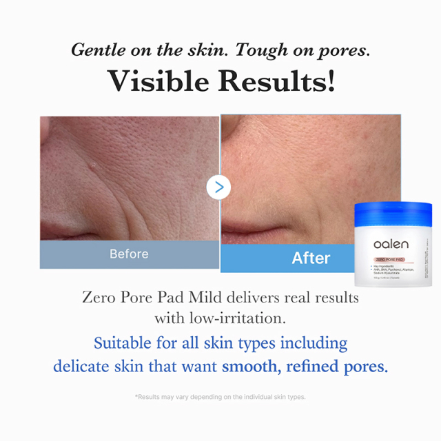 Zero Pore Pad Mild 2.0 Toner Pads PHA Gentle Exfoliation Pore Minimizing Blackhead Removal,oalen cosmetics