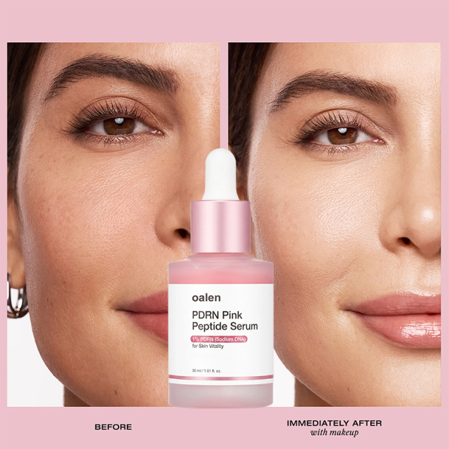 Oalen Private Label Anti-aging Ultra Light PDRN Pink Serum | Hyaluronic Acid Korean Skincare,oalen cosmetics
