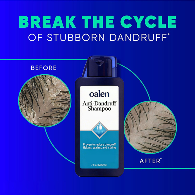 Oalen Private Label Anti-Dandruff Shampoo Clinically Proven 10X Effective Deep Clean Repair Care Scalp Care,oalen cosmetics
