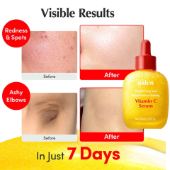Luxfume Vitamin C Serum for Face Anti Aging Wrinkle Facial Serum Skin Brightening Serum for Dark Spots Fine Lines Dull Skin,oalen cosmetics
