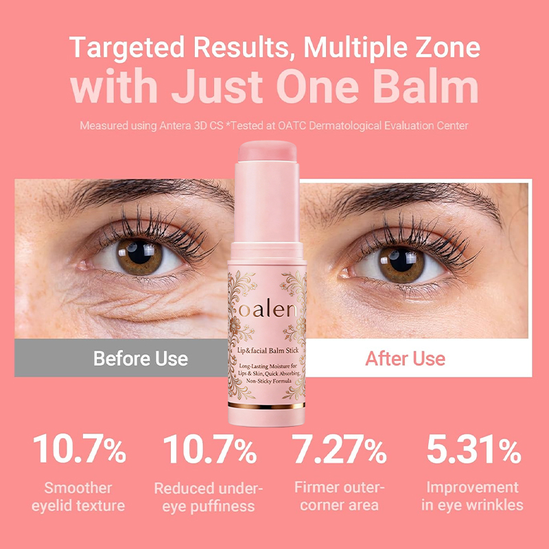 Oalen Private Label Multi Balm Stick Lip Balm Stick with PDRN Collagen Wrinkle Bounce Hydrating Skin Care,MY SHOP