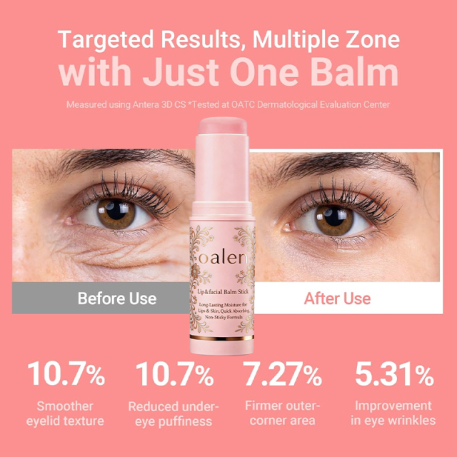 Oalen Private Label Multi Balm Stick Lip Balm Stick with PDRN Collagen Wrinkle Bounce Hydrating Skin Care,MY SHOP