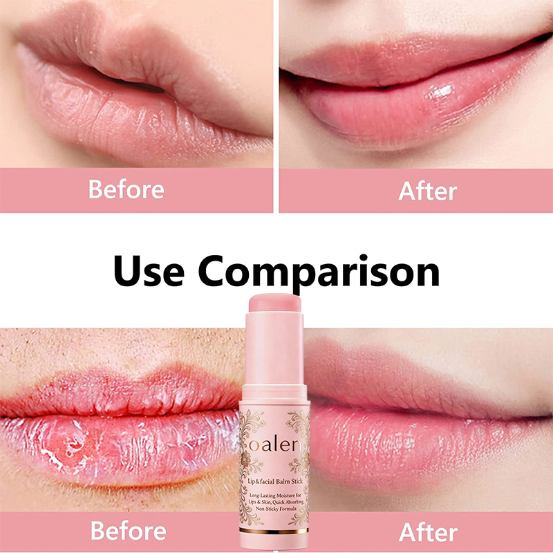 Oalen Private Label Multi Balm Stick Lip Balm Stick with PDRN Collagen Wrinkle Bounce Hydrating Skin Care,MY SHOP