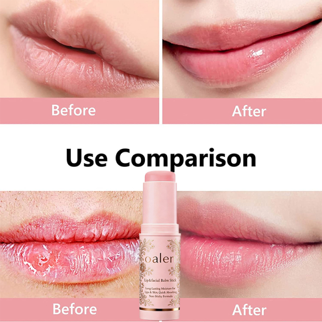 Oalen Private Label Multi Balm Stick Lip Balm Stick with PDRN Collagen Wrinkle Bounce Hydrating Skin Care,MY SHOP