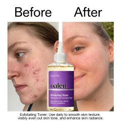 Oalen Private Label Daily Exfoliating Facial Toner Gentle Brightening Formula Refines Rough Skin for Uniform Skin Tone,MY SHOP
