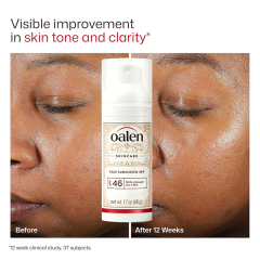 Oalen SPF46 Oil-Free Niacinamide Face Sunscreen | Broad Spectrum Non-Greasy Daily UV Protection,MY SHOP