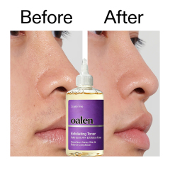 Oalen Private Label Daily Exfoliating Facial Toner Gentle Brightening Formula Refines Rough Skin for Uniform Skin Tone,MY SHOP