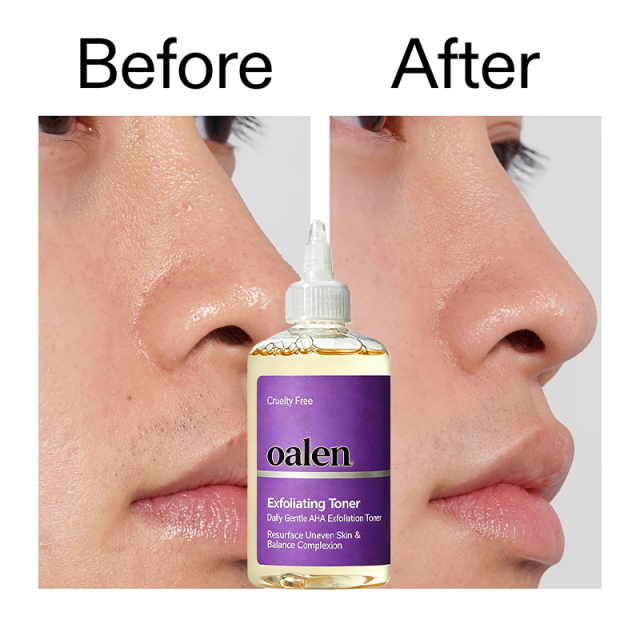Oalen Private Label Daily Exfoliating Facial Toner Gentle Brightening Formula Refines Rough Skin for Uniform Skin Tone,MY SHOP