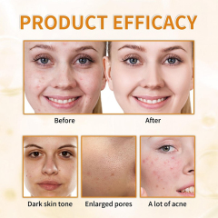 Oalen Private Label Daily Exfoliating Facial Toner Gentle Brightening Formula Refines Rough Skin for Uniform Skin Tone,MY SHOP