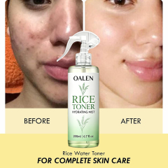 Oalen Private Label Multi Purpose Rice Water Mist Hydrate Revitalize Skin Soften Hair Lightweight Non Sticky Toner,MY SHOP