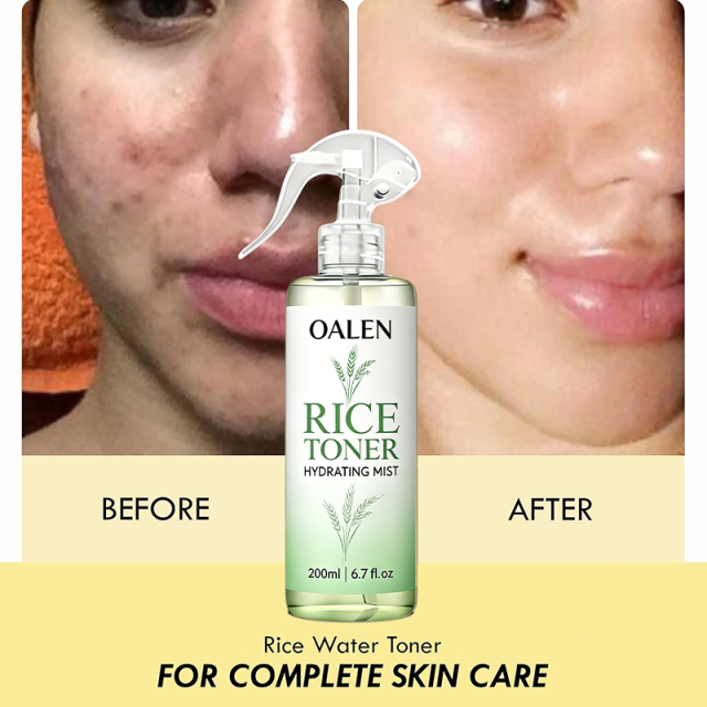 Oalen Private Label Multi Purpose Rice Water Mist Hydrate Revitalize Skin Soften Hair Lightweight Non Sticky Toner,MY SHOP