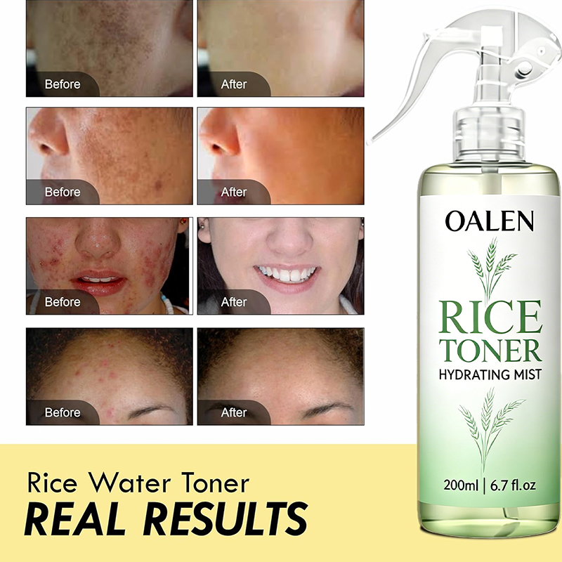 Oalen Private Label Multi Purpose Rice Water Mist Hydrate Revitalize Skin Soften Hair Lightweight Non Sticky Toner,MY SHOP