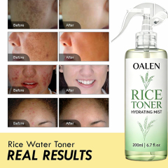 Oalen Private Label Multi Purpose Rice Water Mist Hydrate Revitalize Skin Soften Hair Lightweight Non Sticky Toner,MY SHOP