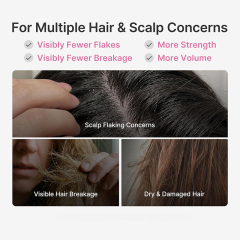 Oalen Rosemary PDRN Thickening Shampoo Mint Cooling Care Support Healthy Scalp Reduce Breakage Volumize Thinning Fine Hair,MY SHOP