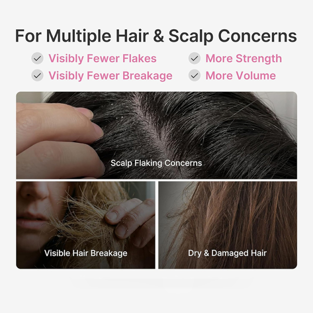 Oalen Rosemary PDRN Thickening Shampoo Mint Cooling Care Support Healthy Scalp Reduce Breakage Volumize Thinning Fine Hair,MY SHOP