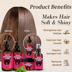 Oalen Rosemary Mint Hair Care Set Shampoo Conditioner Hair Oil Mask Anti Hair Loss Repair Growth Treatment for All Hair Types,MY SHOP