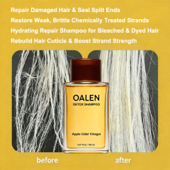 Oalen private label volumize detox shampoo and conditioner set for fine thin hair adds lasting fluffy volume,MY SHOP