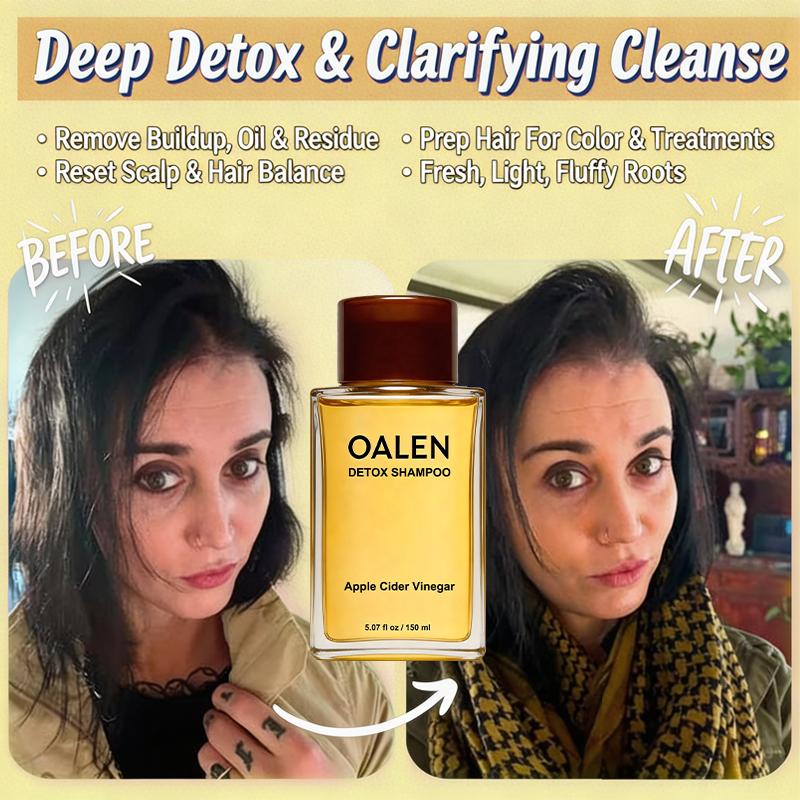 Oalen private label volumize detox shampoo and conditioner set for fine thin hair adds lasting fluffy volume,MY SHOP