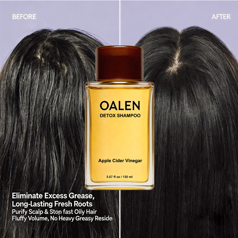 Oalen private label volumize detox shampoo and conditioner set for fine thin hair adds lasting fluffy volume,MY SHOP