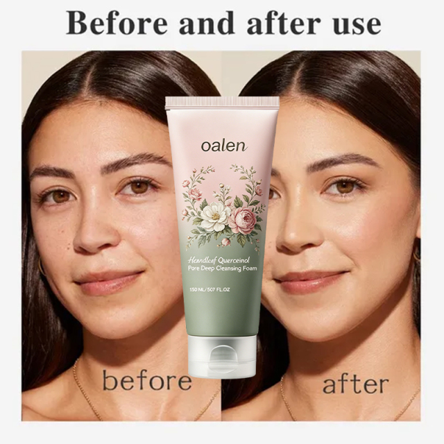 oalen private label heartleaf gentle foaming cleanser deep pore cleansing hydrating daily face wash pore refining skincare product,MY SHOP