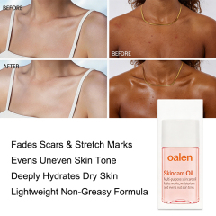 oalen private label Skincare Body Oil Serum vitamins moisturize face body fade scars stretch marks all skin non comedogenic gentle daily care,MY SHOP