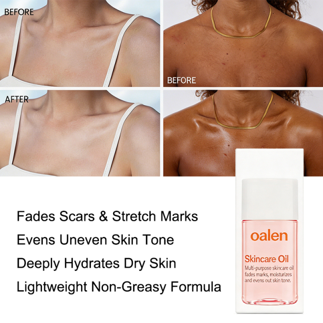 oalen private label Skincare Body Oil Serum vitamins moisturize face body fade scars stretch marks all skin non comedogenic gentle daily care,MY SHOP