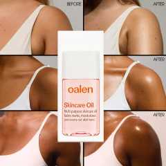 oalen private label Skincare Body Oil Serum vitamins moisturize face body fade scars stretch marks all skin non comedogenic gentle daily care,MY SHOP