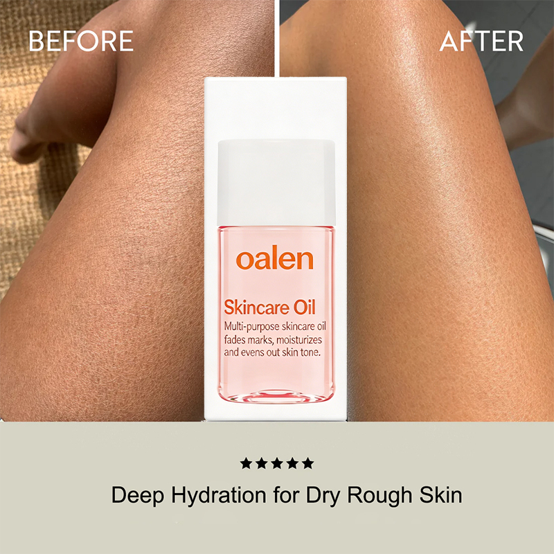 oalen private label Skincare Body Oil Serum vitamins moisturize face body fade scars stretch marks all skin non comedogenic gentle daily care,MY SHOP