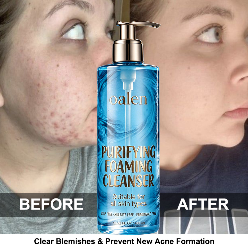 Foaming Facial Cleanser Oil Free Face Wash for Women and Men with Niacinamide and Ceramides Pore Cleanser Safe For Sensitive Skin Will Not Dry Out Skin Soap Free,MY SHOP