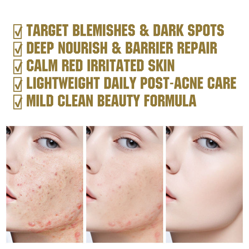 Relief Cream PDRN and Hyaluronic Acid Hydrating Blemish Care Post Acne Face Moisturizer with Centella and Niacinamide Korean Vegan Skincare,MY SHOP