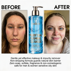 Foaming Facial Cleanser Oil Free Face Wash for Women and Men with Niacinamide and Ceramides Pore Cleanser Safe For Sensitive Skin Will Not Dry Out Skin Soap Free,MY SHOP