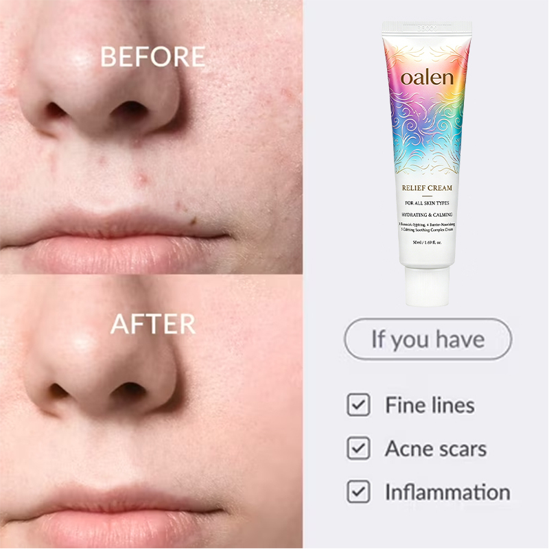 Relief Cream PDRN and Hyaluronic Acid Hydrating Blemish Care Post Acne Face Moisturizer with Centella and Niacinamide Korean Vegan Skincare,MY SHOP