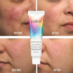 Relief Cream PDRN and Hyaluronic Acid Hydrating Blemish Care Post Acne Face Moisturizer with Centella and Niacinamide Korean Vegan Skincare,MY SHOP