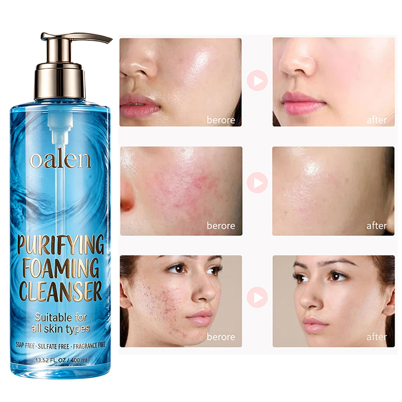 Foaming Facial Cleanser Oil Free Face Wash for Women and Men with Niacinamide and Ceramides Pore Cleanser Safe For Sensitive Skin Will Not Dry Out Skin Soap Free,MY SHOP