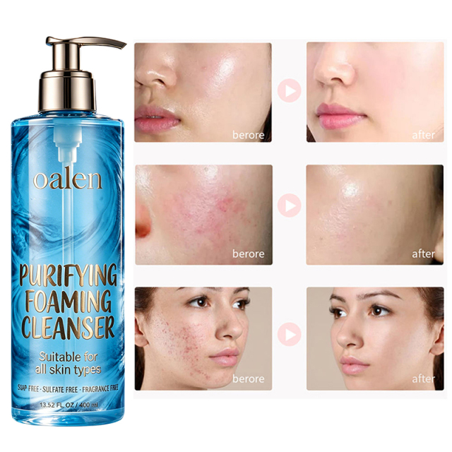 Foaming Facial Cleanser Oil Free Face Wash for Women and Men with Niacinamide and Ceramides Pore Cleanser Safe For Sensitive Skin Will Not Dry Out Skin Soap Free,MY SHOP