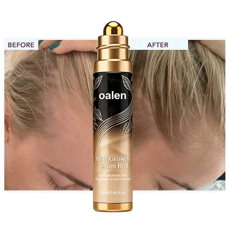 Oalen Hair Growth Serum Roll On, Forehead Hair Regrowth Roller Serum, Anti Hair Loss Scalp Treatment Oil, Nourish Thinning Hair Boost Baby Hair Growth for Men Women 25ml,MY SHOP