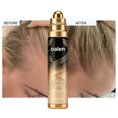 Oalen Hair Growth Serum Roll On, Forehead Hair Regrowth Roller Serum, Anti Hair Loss Scalp Treatment Oil, Nourish Thinning Hair Boost Baby Hair Growth for Men Women 25ml,MY SHOP