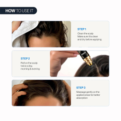 Oalen Hair Growth Serum Roll On, Forehead Hair Regrowth Roller Serum, Anti Hair Loss Scalp Treatment Oil, Nourish Thinning Hair Boost Baby Hair Growth for Men Women 25ml,MY SHOP