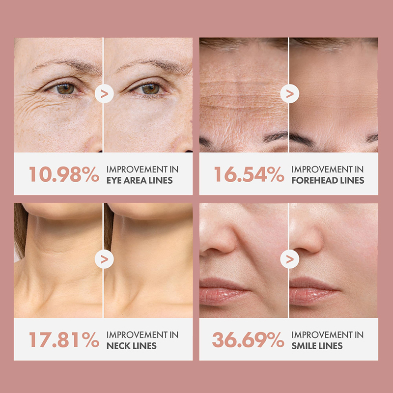 Oalen Private Label PDRN Pink Collagen Volume Multi Balm Multi Repair Stick For Dry Fine Lines Dark Circles Sagging Dull Skin On Eye Cheek Lip And Neck,MY SHOP