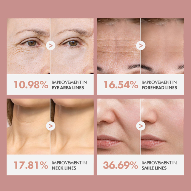 Oalen Private Label PDRN Pink Collagen Volume Multi Balm Multi Repair Stick For Dry Fine Lines Dark Circles Sagging Dull Skin On Eye Cheek Lip And Neck,MY SHOP