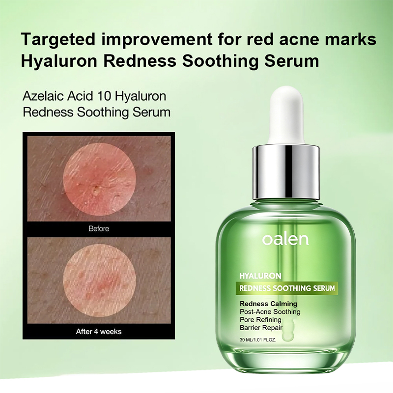 oalen private label azelaic acid serum with hyaluronic acid redness soothing facial care for oily and blemish prone skin lightweight hydrating treatment,MY SHOP