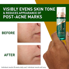 oalen private label resurfacing retinol serum with licorice root extract brightening minimizer for post acne skin barrier repair,MY SHOP