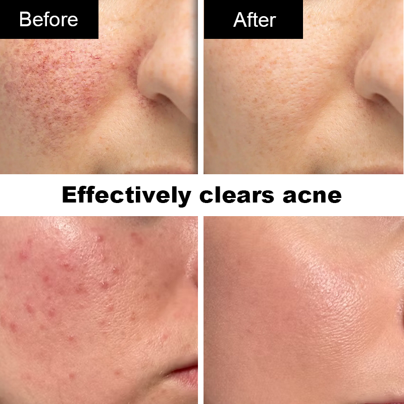 Luxfume Private Label Resurfacing Facial Serum with Licorice Root Extract Oil Free Pore Minimizing Retinol Treatment,MY SHOP